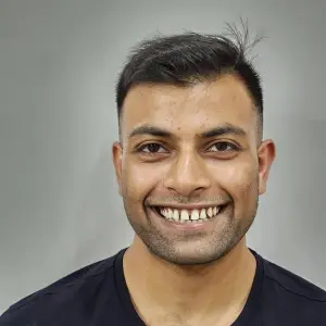 Patient smile before treatment