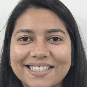 Patient smile after treatment