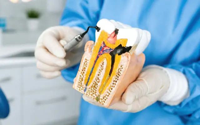 Dentist holding a tooth cross-section model that shows the root canals