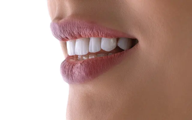 Close-up of a smile with bright white teeth